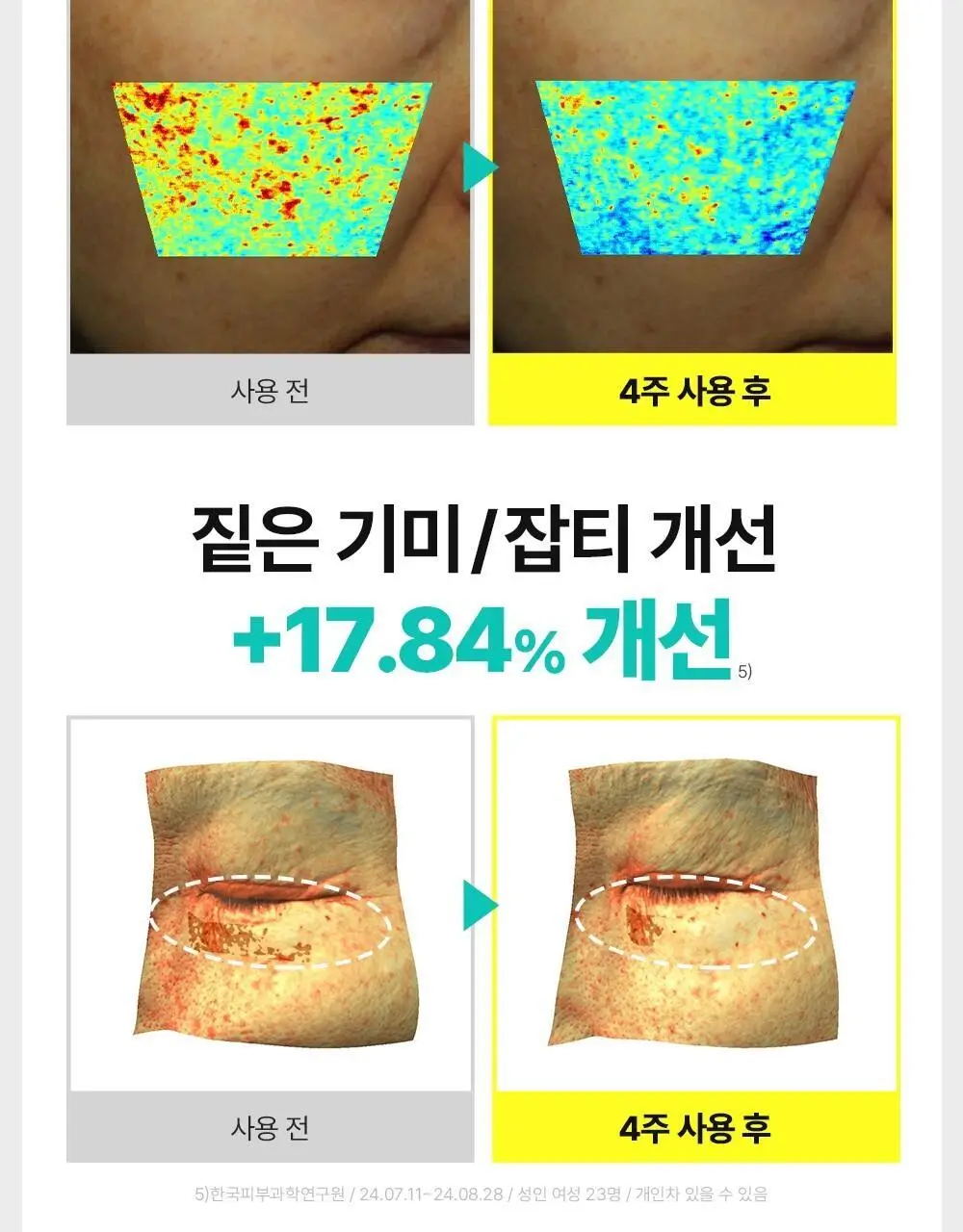 [아이백패치] 더마펌 비타액티브 마이크로크리스탈 패치플러스 3종 택1 상세페이지 25